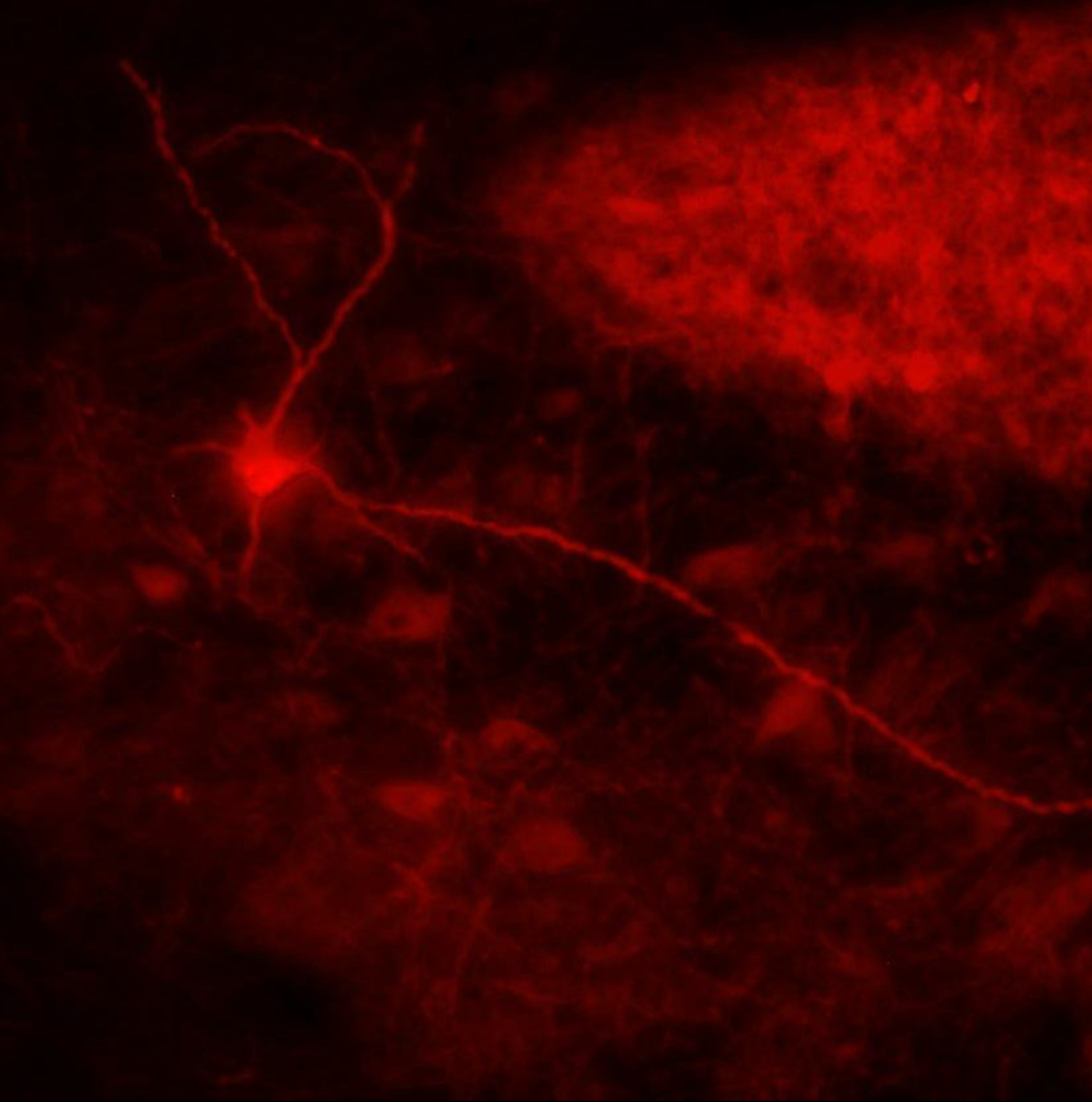fluorescent neuron